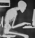 posture xray